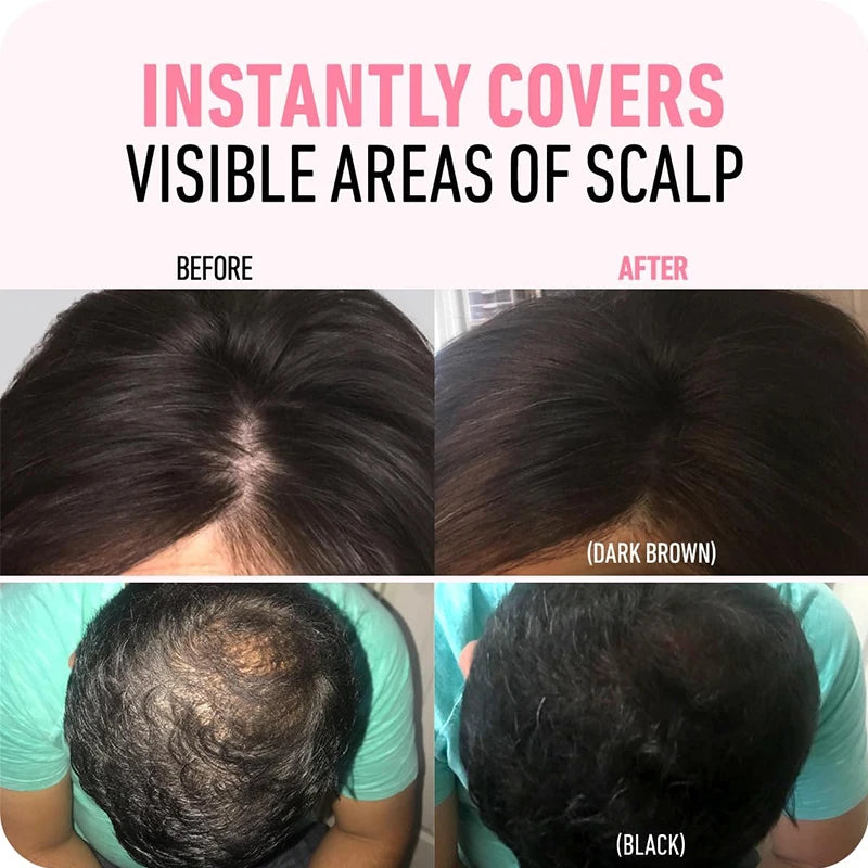 Before and after results using hairline shadow powder to conceal thinning hair and scalp